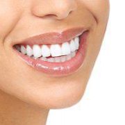 veneers